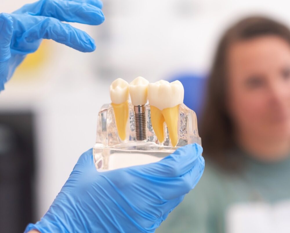 ile kosztuje implant zęba u dentysty