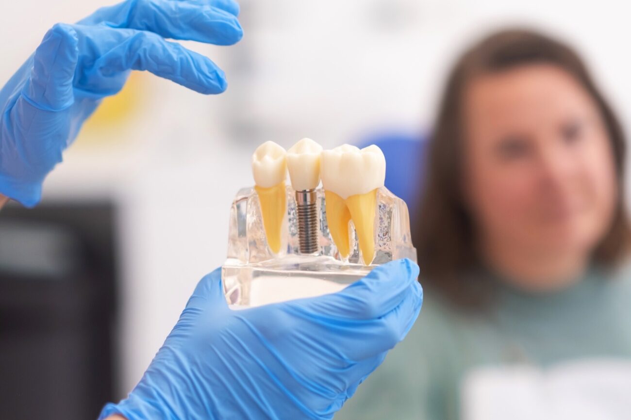 ile kosztuje implant zęba u dentysty
