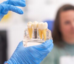 ile kosztuje implant zęba u dentysty